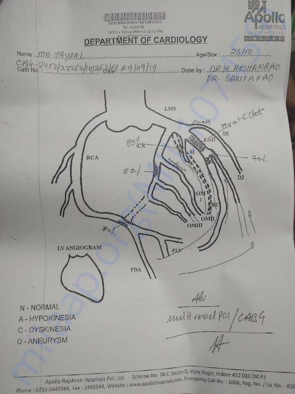Heart Blok image