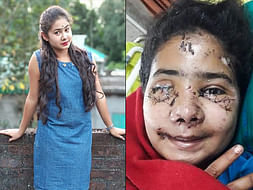 21-Year-Old Needs An Eye Transplant After A Road Accident