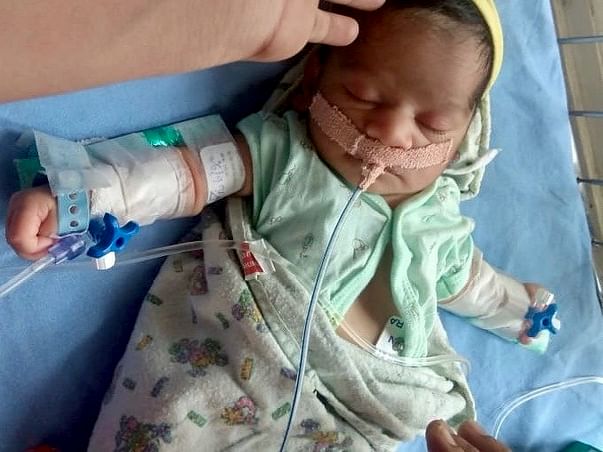 Help 9 Days Old, Rupali Ishwar From Suffering Heart Ailment