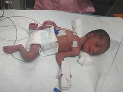 Help My Baby Recover In NICU