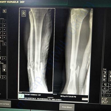 Medical Report