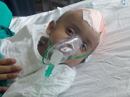 Help Our Baby Undergo Brain Operation
