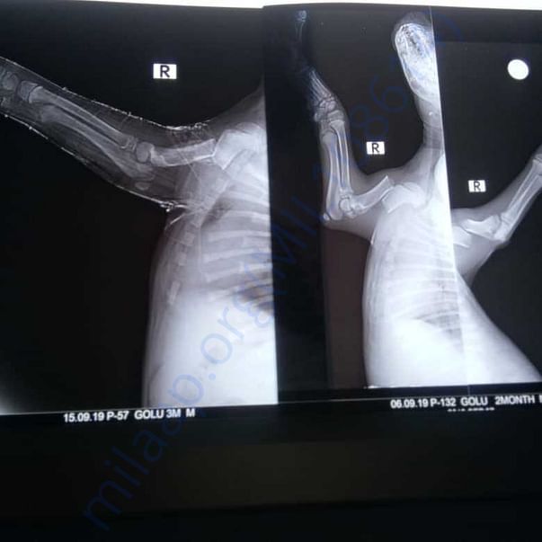 Medical Report