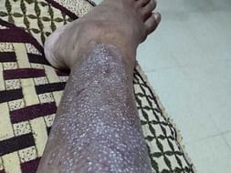 Help Me for My Medical Expenses