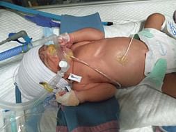 Help Baby Boy for Exploratory Laparotomy Surgery