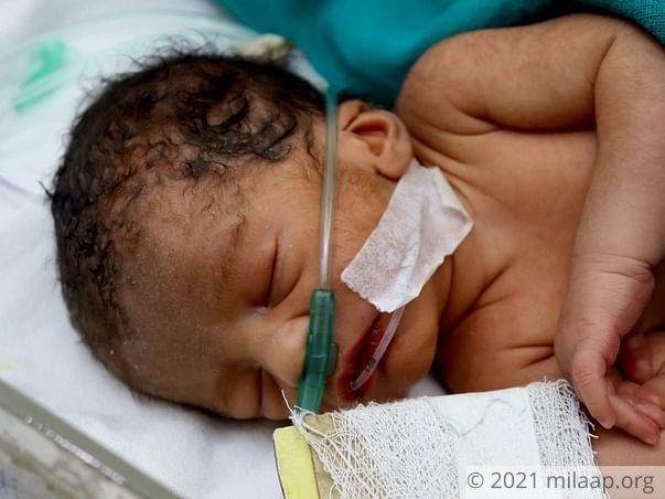 Help Arti's Preterm Baby Survive