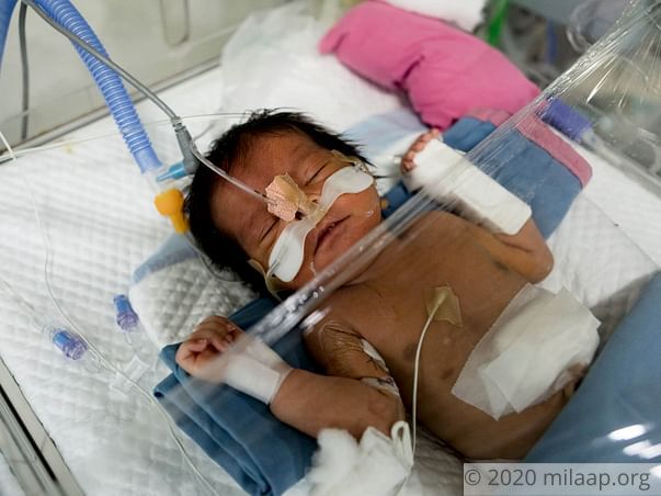 Help Swathi's Preterm Baby Survive