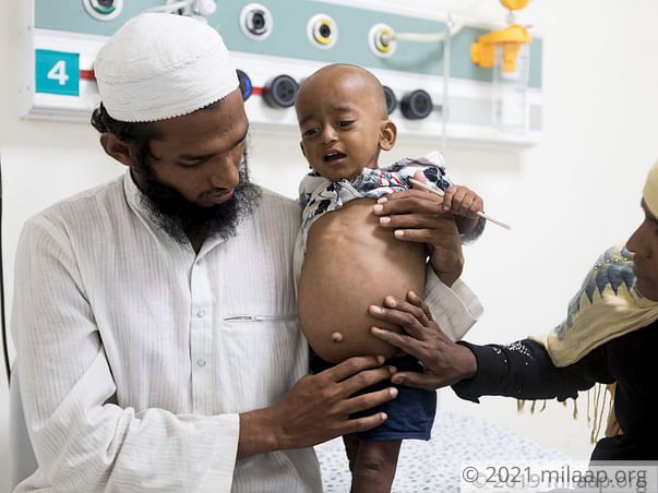 Help Baby Muzzamil Fight Chronic Liver Disease