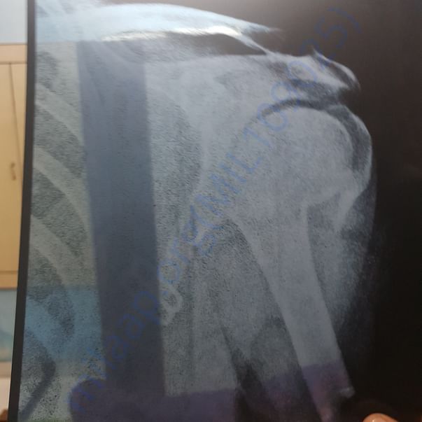Medical Report