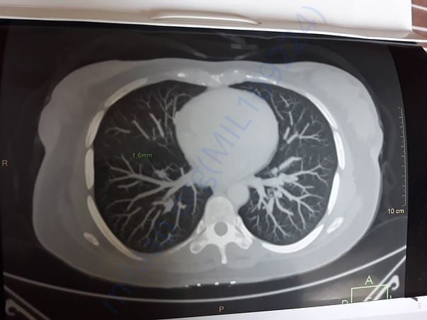 Mri