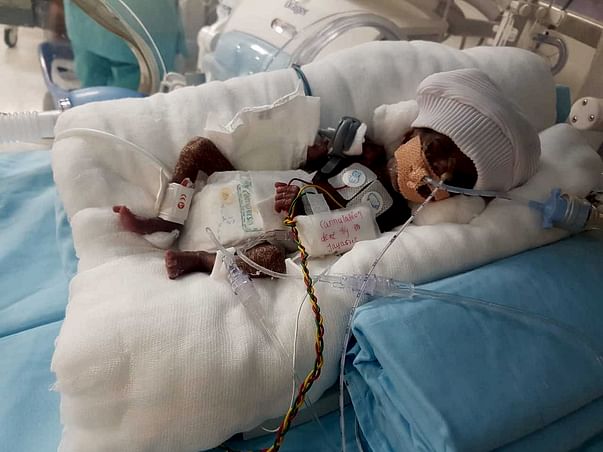 Help Baby Of Sowjanya To Survive