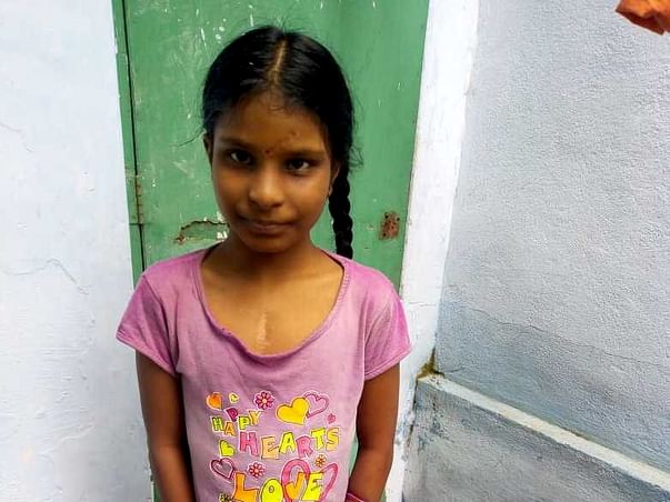 8 Years Old Sharavani Needs Your Help To Fight Congenital Heart Defect