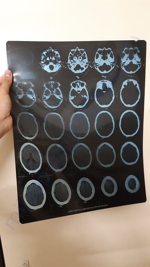 MRI & CT scan