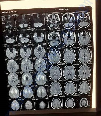 mri