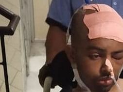 Help Syed Mubeen hussain to recover fully