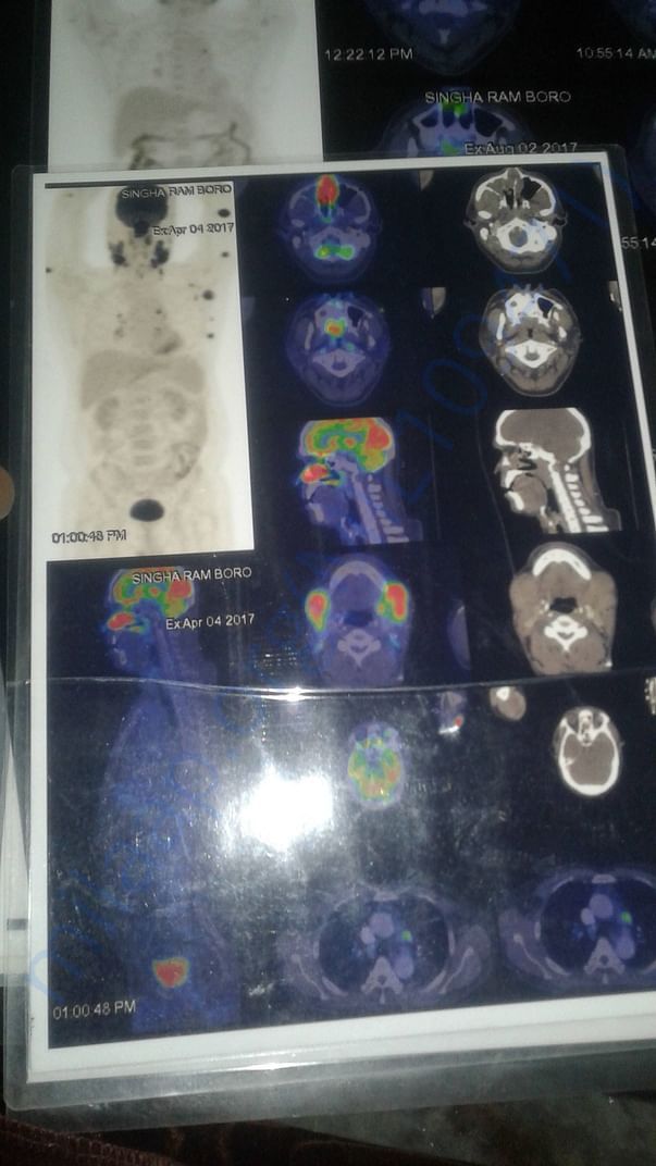 Help us for medical treatment