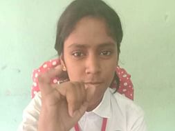 Help Bipasha For Orthodontic Surgery