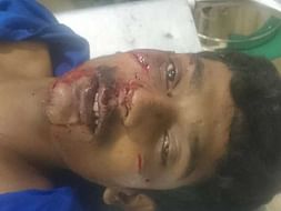 Help Me To Undergo Treatment For My Right Leg Fatal Accident