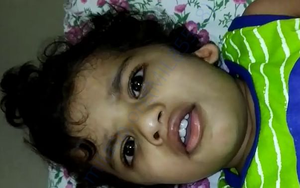 Advait Left Ear