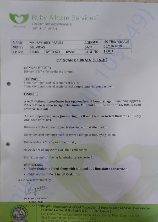 CT scan Report of my aunt