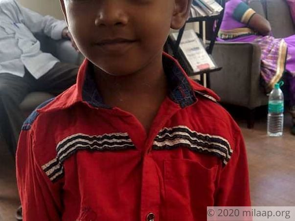 Help Monish Ram Undergo Open Heart Surgery