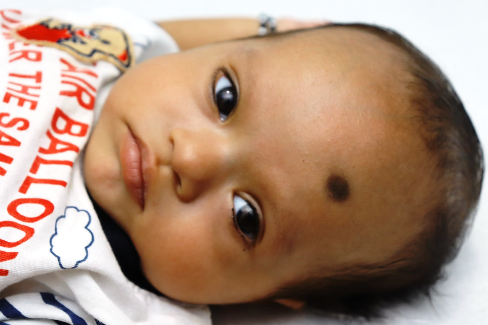 A Heart Attack Can Kill This 3MonthOld Baby If He Doesn