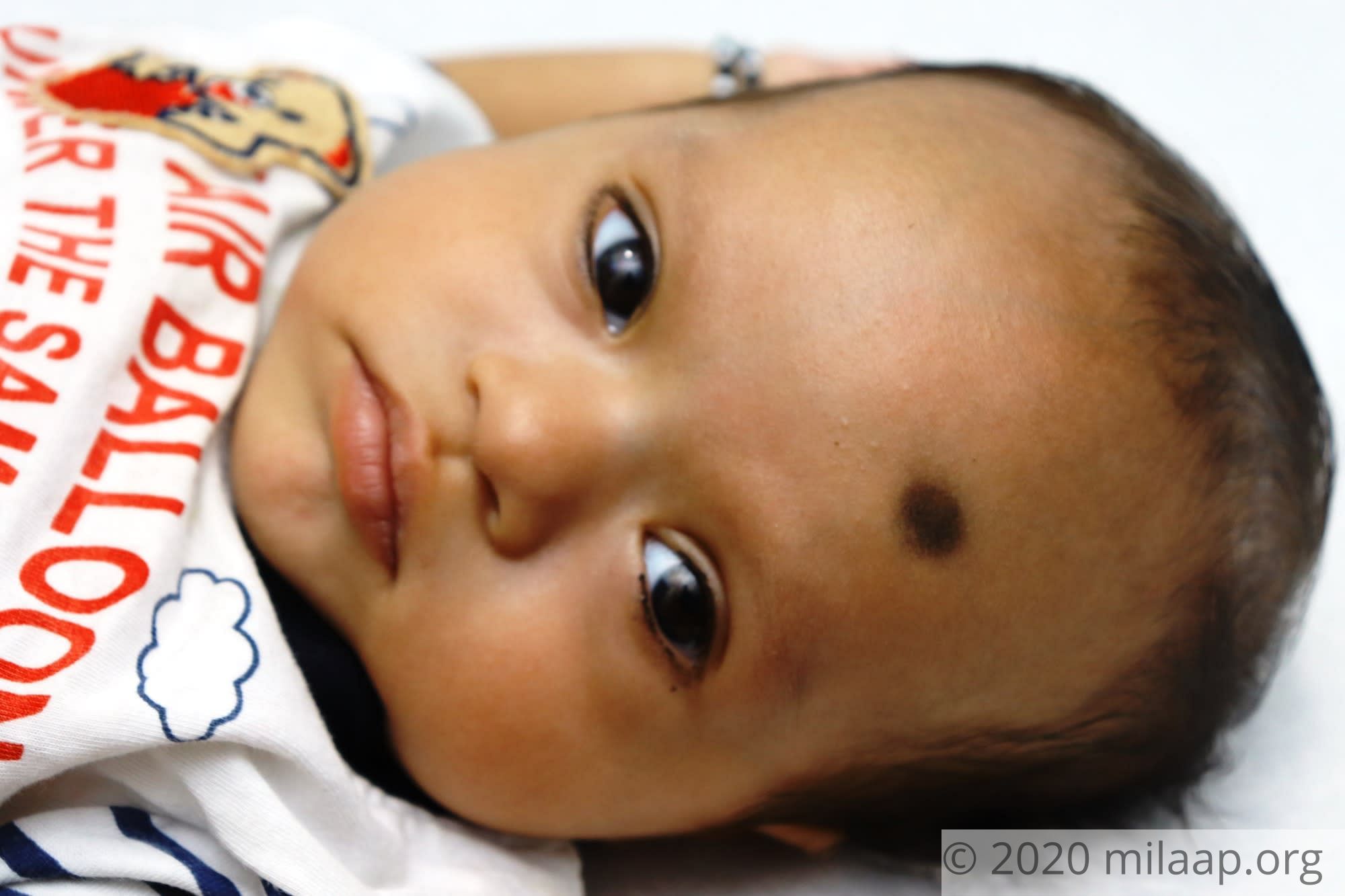 A Heart Attack Can Kill This 3-Month-Old Baby If He Doesn ...
