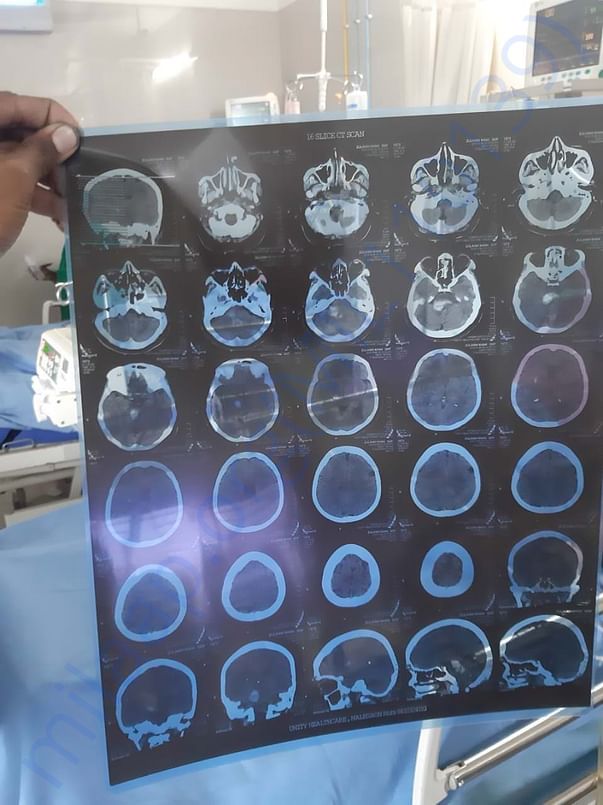 CT-Scan2