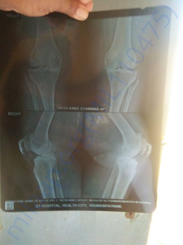 X-ray