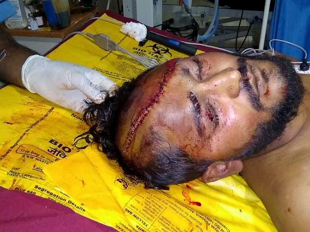 Help sourabh to Fight with head injury