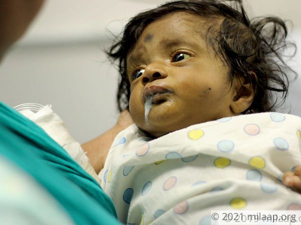 Help Magizhini Fight Biliary Atresia And Undergo A Liver Transplant