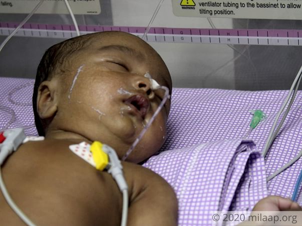 Help Baby Hamza Recover From Seizures and Sepsis