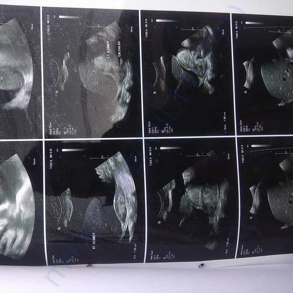 Medical Report