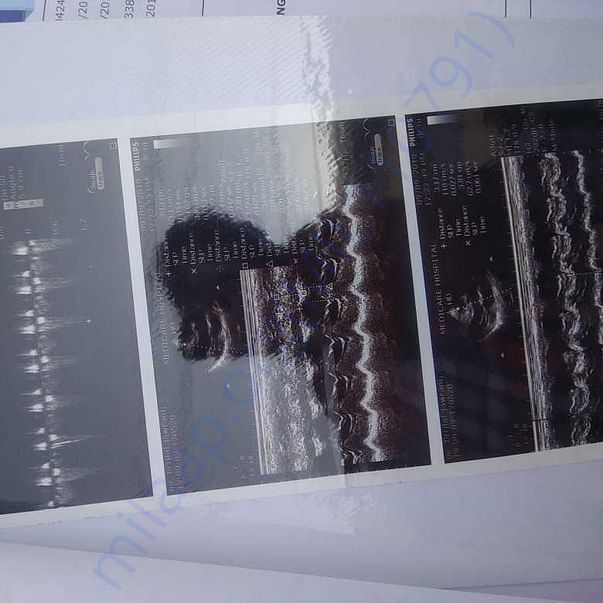 Medical Report