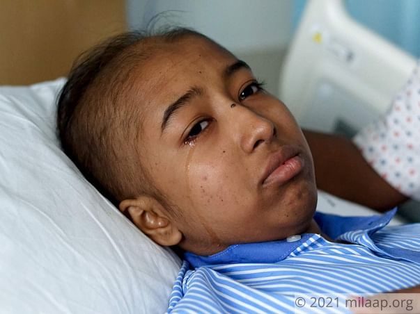 Her Twin Is A Reminder Of Her Life Before She Got Cancer