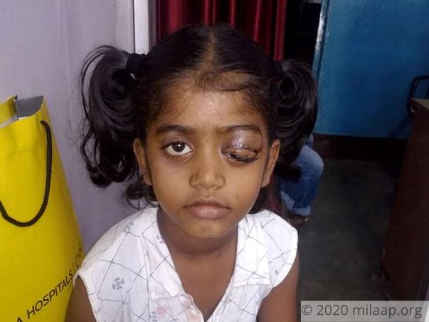 Help D. Lija Fight Orbital Rhabdomyosarcoma