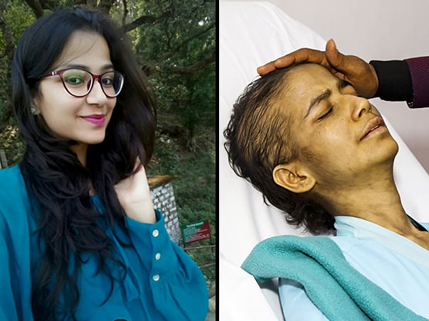 Help My Friend Himani Joshi to Fight Cancer