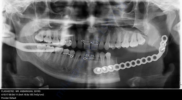 scanning report