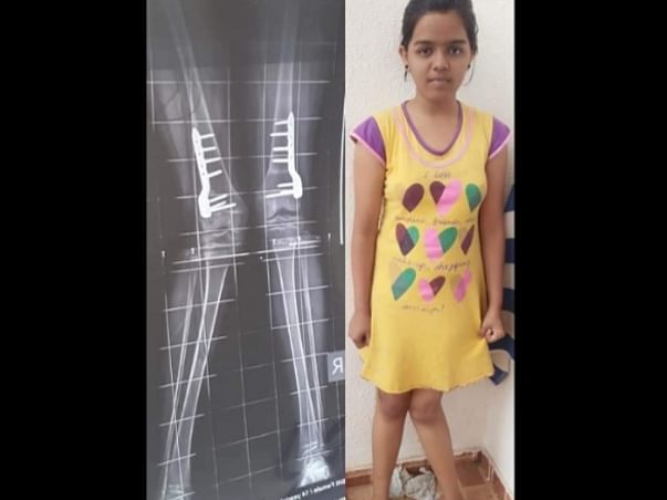 Help a 13 Year Old With Her Bilateral Implant Removal