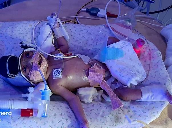 Help Premature 3 Days Old Baby Fight For Kidney Dialysis