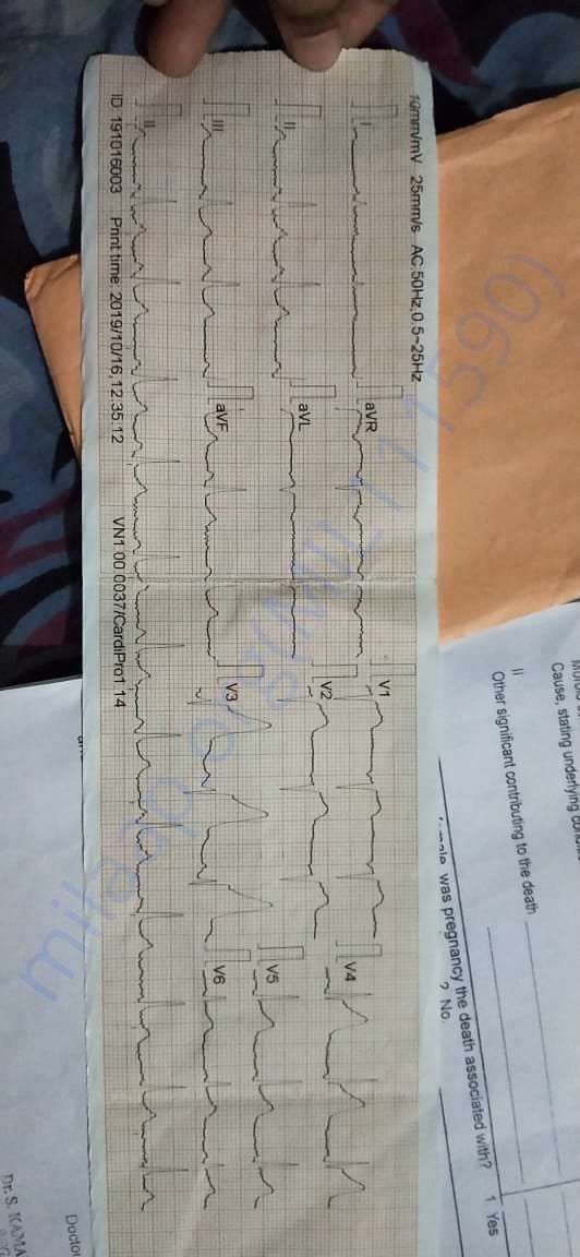 Her father's ECG