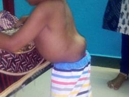 Support Guhan Recover From Spinal Stenosis