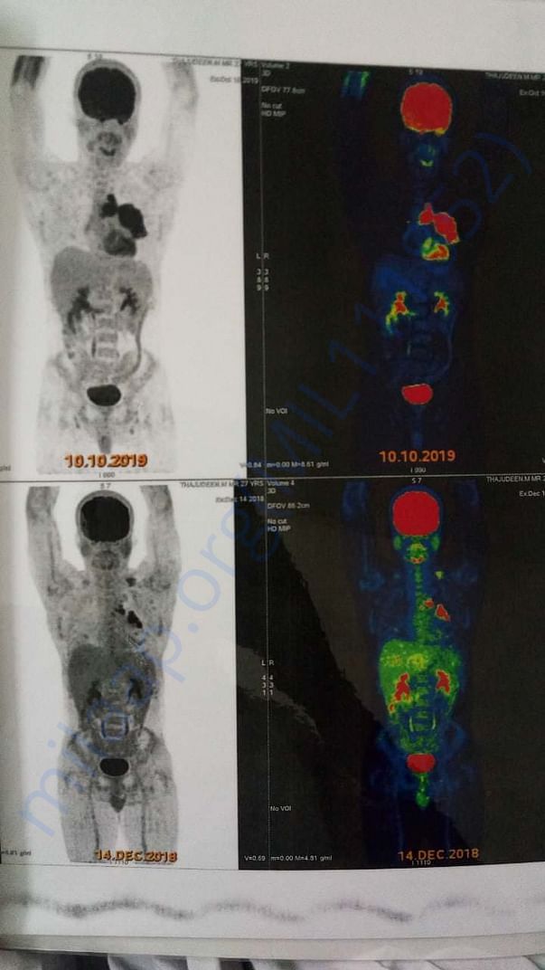 Scan report