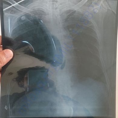 Medical Report