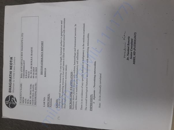 BIOPSY REPORT