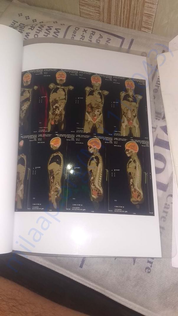 Anas Xray3