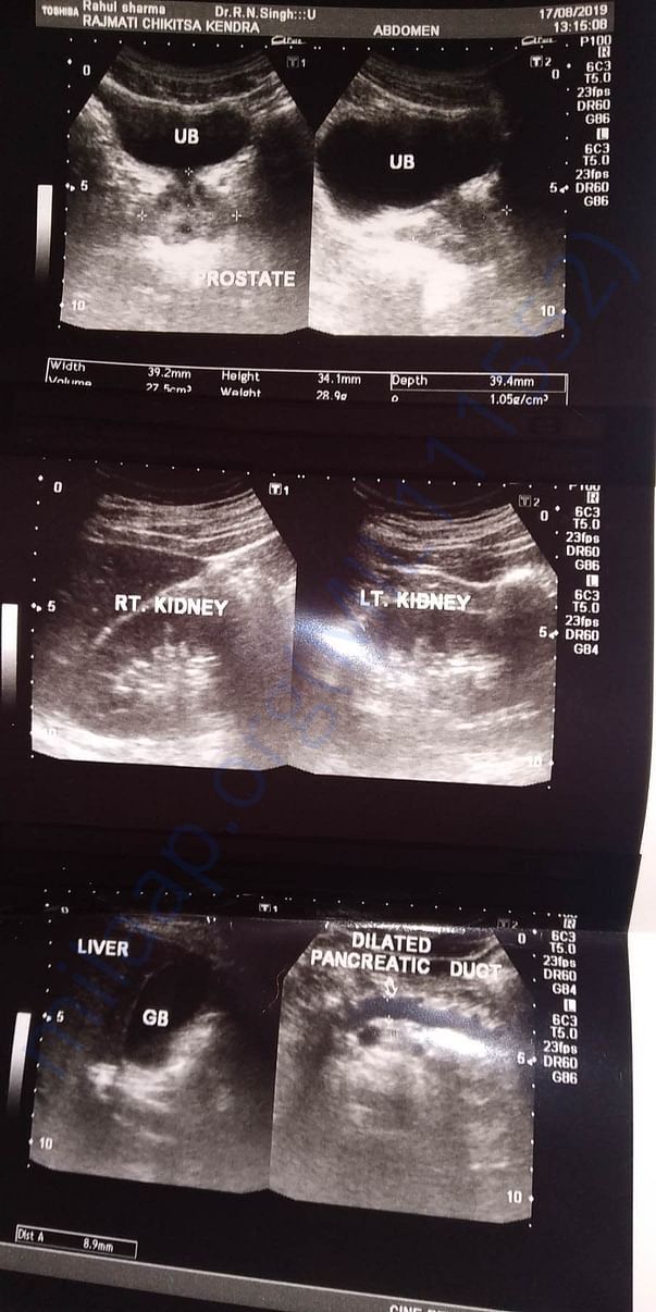 Medical scan