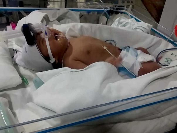 10 days old Baby of Khima Kadel needs your help fight Cardiac disease
