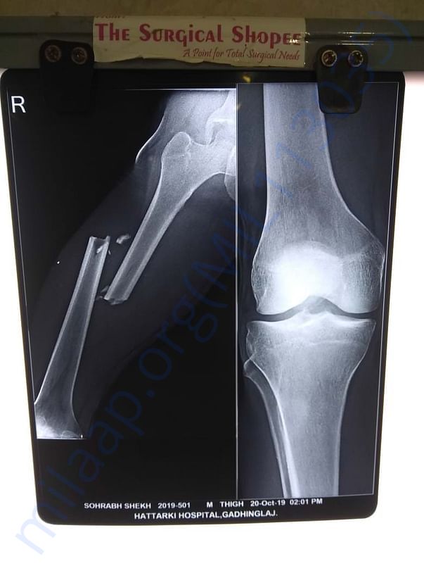 X ray and medical document of hispital