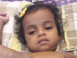 Sayana Krishna Needs Your Support To Fight Multiple Intestinal Atresia